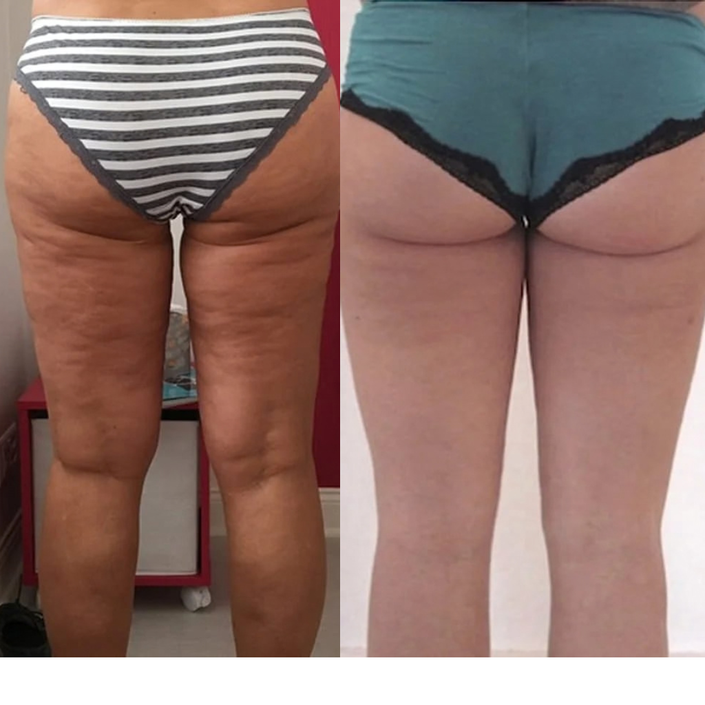 3D Sculpt & Smooth Shorts